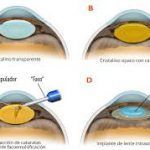 images (2)